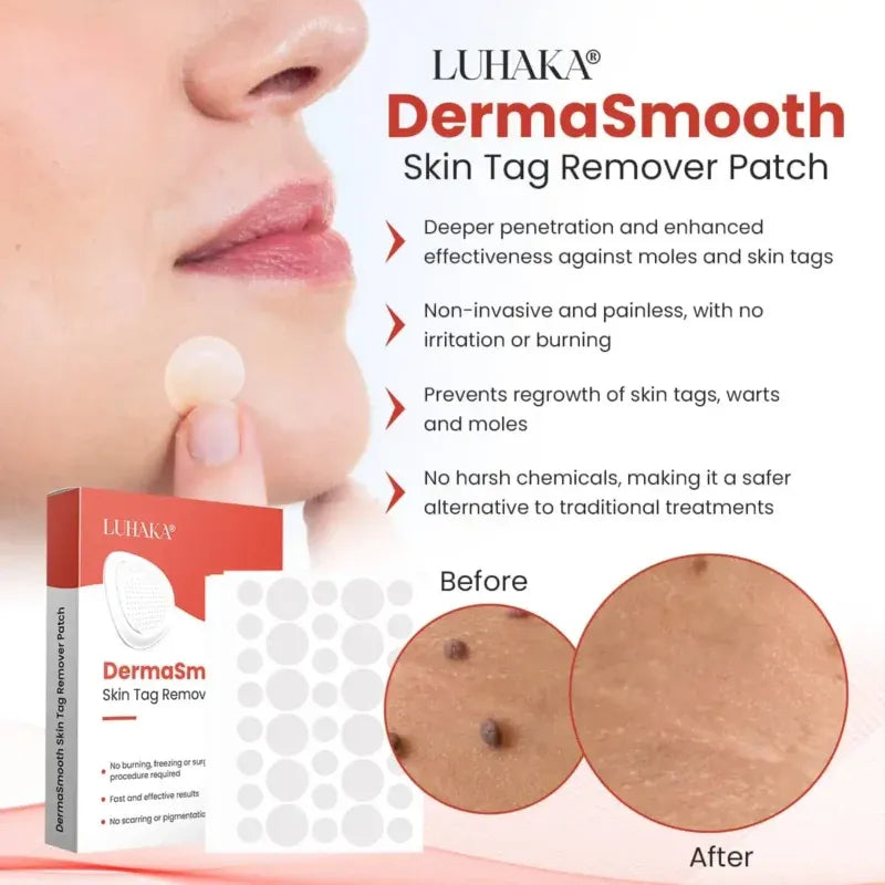 Derma Smooth Skin Tag Removal Patch | 🔥BUY 1 GET 1 FREE🔥
